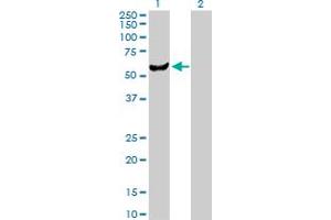 Western Blot analysis of UMPS expression in transfected 293T cell line by UMPS MaxPab polyclonal antibody.