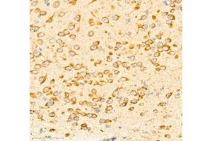 Immunohistochemistry (Paraffin-embedded Sections) (IHC (p)) image for anti-Protein Tyrosine Phosphatase G1 (PTPN12) antibody (ABIN7075292)