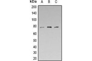 Western blot analysis of Synapsin 1 (pS553) expression in HEK293T (A), mouse brain (B), rat brain (C) whole cell lysates. (SYN1 抗体  (pSer553))