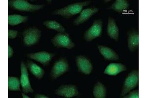 Immunostaining analysis in HeLa cells.