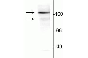 Western Blotting (WB) image for anti-Progesterone Receptor (PGR) (pSer294) antibody (ABIN361518)