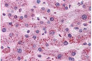 Human Liver: Formalin-Fixed, Paraffin-Embedded (FFPE) (Cyclin D1 抗体)
