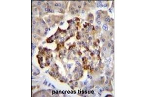 Immunohistochemistry (Paraffin-embedded Sections) (IHC (p)) image for anti-Glutamate Decarboxylase 2 (Pancreatic Islets and Brain, 65kDa) (GAD2) (AA 109-138) antibody (ABIN655070)