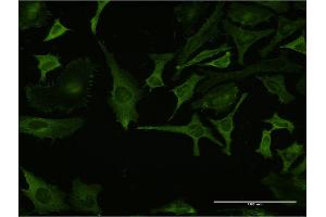 Immunofluorescence of monoclonal antibody to RPL32 on HeLa cell. (RPL32 抗体  (AA 33-132))