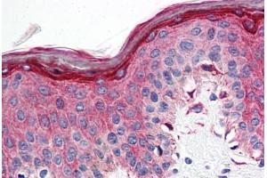 Anti-5HT1E Receptor antibody  ABIN1048261 IHC staining of human skin. (Serotonin Receptor 1E 抗体  (Cytoplasmic Domain))
