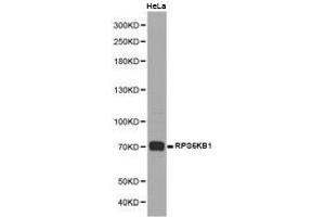 Western Blotting (WB) image for anti-Ribosomal Protein S6 Kinase, 70kDa, Polypeptide 1 (RPS6KB1) antibody (ABIN1874663) (RPS6KB1 抗体)