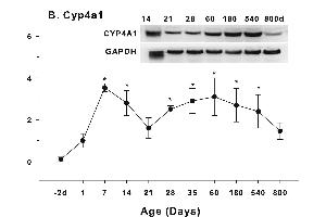 Age-related expression of CYP-4 family gene/proteins in livers of male rats. (CYP4A11 抗体  (AA 351-450))