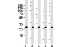 Western blot analysis of lysate from 1) 293, 2) MCF-7, 3) HepG2, 4) mouse NIH3T3 cell line and 5) rat liver tissue using PHB1 antibody at 1:1000. (Prohibitin 抗体)