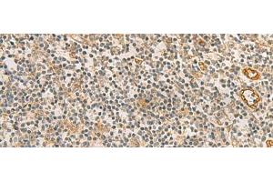Immunohistochemistry of paraffin-embedded Human tonsil tissue using RAB13 Polyclonal Antibody at dilution of 1:50(x200) (RAB13 抗体)