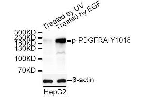 Western blot analysis of extracts of HepG2 cells, using Phospho-PDGFRA-Y1018 antibody. (PDGFRA 抗体  (pTyr1018))