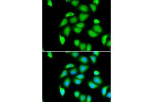 Immunofluorescence analysis of U20S cell using RPS5 antibody. (RPS5 抗体)