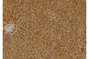 ABIN6258410 and ABIN6275557 at 1/100 staining Mouse liver tissue by IHC-P.