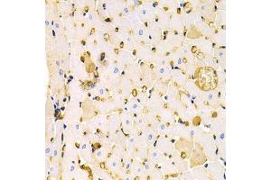 Immunohistochemistry (IHC) image for anti-Potassium Voltage-Gated Channel, Subfamily H (Eag-Related), Member 2 (KCNH2) antibody (ABIN3023436) (KCNH2 抗体)