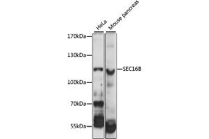 Western blot analysis of extracts of various cell lines, using SEC16B antibody (ABIN6292556) at 1:1000 dilution. (SEC16B 抗体)