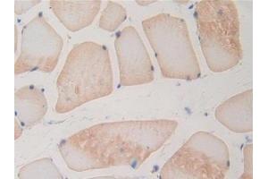 DAB staining on IHC-P; Samples: Rat Skeletal muscle Tissue (BMP15 抗体  (AA 269-391))