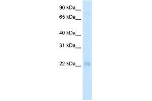 WB Suggested Anti-CSRP3 Antibody   Titration: 2. (CSRP3 抗体  (Middle Region))