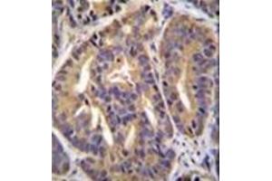 Immunohistochemistry (Paraffin-embedded Sections) (IHC (p)) image for anti-General Transcription Factor IIH, Polypeptide 2C (GTF2H2C) (AA 321-351), (C-Term) antibody (ABIN952647)