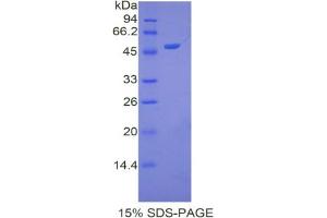 SDS-PAGE analysis of Human Apolipoprotein A5 Protein. (APOA5 蛋白)