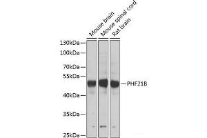 Western blot analysis of extracts of various cell lines using PHF21B Polyclonal Antibody at dilution of 1:1000. (PHF21B 抗体)