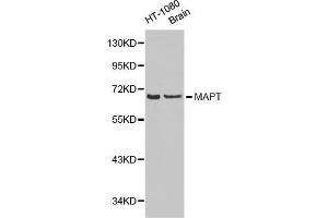 Western Blotting (WB) image for anti-Microtubule-Associated Protein tau (MAPT) (AA 1-100) antibody (ABIN3021442) (MAPT 抗体  (AA 1-100))