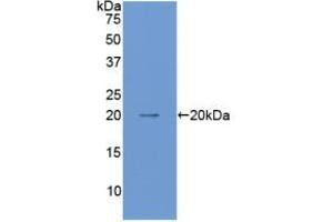 Western blot analysis of recombinant Mouse ANGPT1. (Angiopoietin 1 抗体  (AA 253-429))