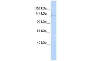 WB Suggested Anti-ZNF445 Antibody Titration:  0. (ZNF445 抗体  (Middle Region))