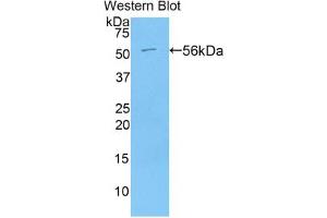 Western blot analysis of the recombinant protein. (Angiotensin I Converting Enzyme 1 抗体  (AA 504-597))