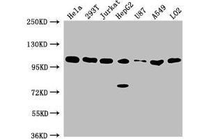 Western Blot Positive WB detected in: Hela whole cell lysate, 293T whole cell lysate, Jurkat whole cell lysate, HepG2 whole cell lysate, U87 whole cell lysate, A549 whole cell lysate, LO2 whole cell lysate All lanes: ADAR antibody at 1:2000 Secondary Goat polyclonal to rabbit IgG at 1/50000 dilution Predicted band size: 137, 134, 132, 141, 104 kDa Observed band size: 104 kDa (ADAR 抗体  (AA 367-471))