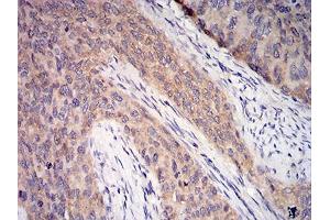 Immunohistochemistry (IHC) image for anti-Complement Component 1, Q Subcomponent, A Chain (C1QA) (AA 23-167) antibody (ABIN5542307)