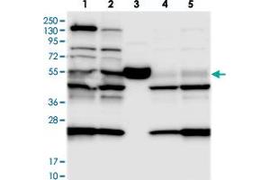 Western blot analysis of Lane 1: RT-4, Lane 2: U-251 MG, Lane 3: Human Plasma, Lane 4: Liver, Lane 5: Tonsil with C11orf84 polyclonal antibody . (C11ORF84 抗体)