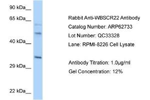 Western Blotting (WB) image for anti-Williams Beuren Syndrome Chromosome Region 22 (WBSCR22) (C-Term) antibody (ABIN2789229) (WBSCR22 抗体  (C-Term))
