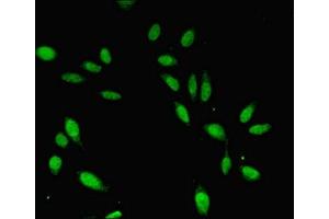 Immunofluorescent analysis of Hela cells using ABIN7147286 at dilution of 1:100 and Alexa Fluor 488-congugated AffiniPure Goat Anti-Rabbit IgG(H+L) (CDC45 抗体  (AA 1-270))