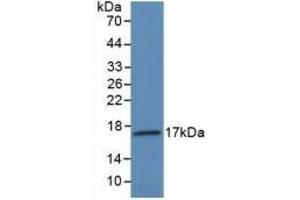 Detection of Recombinant VEGF145, Human using Polyclonal Antibody to Vascular Endothelial Growth Factor 145 (VEGF145) (Vascular Endothelial Growth Factor 145 (AA 28-147) 抗体)