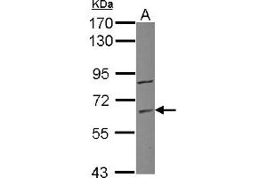 Western Blotting (WB) image for anti-Zinc Finger Protein 282 (ZNF282) (AA 46-303) antibody (ABIN1501833) (ZNF282 抗体  (AA 46-303))