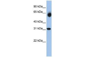 WB Suggested Anti-DHRS2 Antibody Titration:  0. (DHRS2 抗体  (Middle Region))