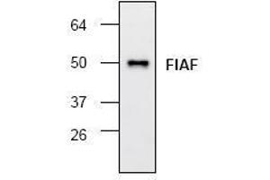 Image no. 1 for anti-Angiopoietin-Like 4 (ANGPTL4) antibody (ABIN127156) (ANGPTL4 抗体)