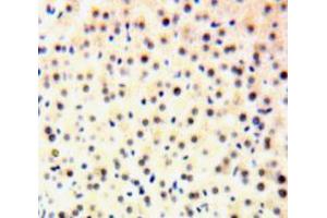IHC-P analysis of Liver tissue, with DAB staining. (GTF2H1 抗体  (AA 84-335))