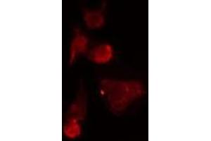 ABIN6275531 staining  HepG2 cells by IF/ICC. (NEK7 抗体  (Internal Region))