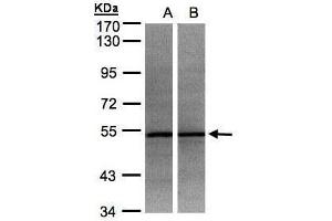 WB Image Sample(30 ug whole cell lysate) A:HeLa S3, B:MOLT4 , 7. (ADPGK 抗体)