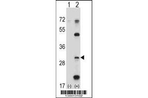 Western blot analysis of PSMB5 using rabbit polyclonal PSMB5 Antibody using 293 cell lysates (2 ug/lane) either nontransfected (Lane 1) or transiently transfected (Lane 2) with the PSMB5 gene.