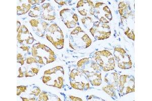 Immunohistochemistry of paraffin-embedded Human stomach using NDUFA5 Polyclonal Antibody at dilution of 1:100 (40x lens). (NDUFA5 抗体)