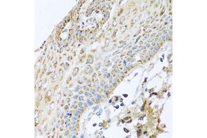 Immunohistochemistry of paraffin-embedded human esophagus using NDUFA2 antibody. (NDUFA2 抗体)