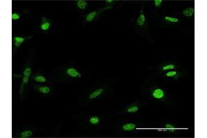 Immunofluorescence of purified MaxPab antibody to RFX5 on HeLa cell. (RFX5 抗体  (AA 1-616))