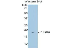 Western blot analysis of the recombinant protein. (Myoglobin 抗体  (AA 1-154))