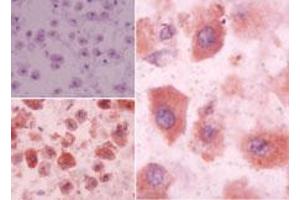 Image no. 1 for anti-Sphingosine-1-Phosphate Receptor 3 (S1PR3) (AA 300-350) antibody (ABIN960336) (S1PR3 抗体  (AA 300-350))