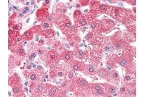 Human Liver (formalin-fixed, paraffin-embedded) stained with ALDH2followed by biotinylated goat anti-rabbit IgG secondary antibody, alkaline phosphatase-streptavidin and chromogen. (ALDH2 抗体  (N-Term))
