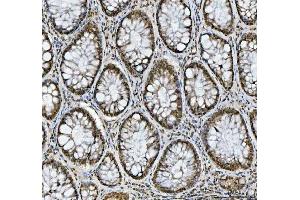 IHC analysis of hnRNP L/HNRNPL using anti-hnRNP L/HNRNPL antibody (ABIN7600130).