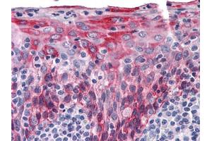 Immunohistochemical analysis of paraffin-embedded human Tonsil tissues using KRT15 mouse mAb (KRT15 抗体)