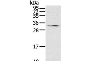 Western Blot analysis of 231 cell using STAR Polyclonal Antibody at dilution of 1:500 (STAR 抗体)