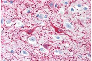 Human Brain, Cortex (formalin-fixed, paraffin-embedded) stained with MAP2 antibody ABIN239819 at 10 ug/ml followed by biotinylated anti-mouse IgG secondary antibody ABIN481714, alkaline phosphatase-streptavidin and chromogen. (MAP2 抗体)